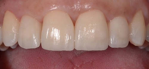 After image