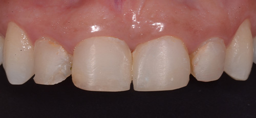 Before image