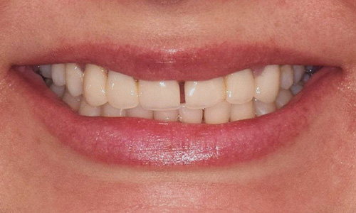 Before image