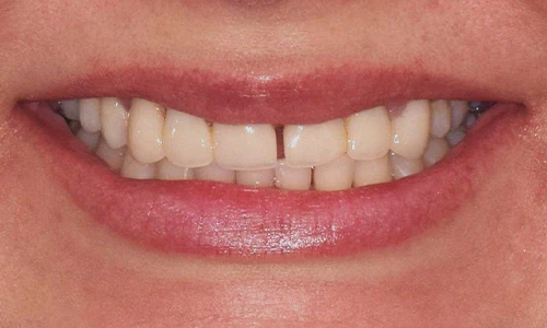 Before image