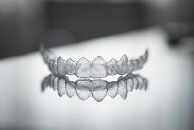 Invisalign offered at Broadwing Dental Studio