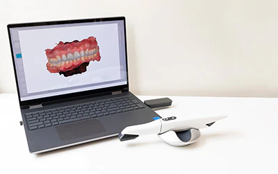 intraoral camera used at Broadwing Dental Studio