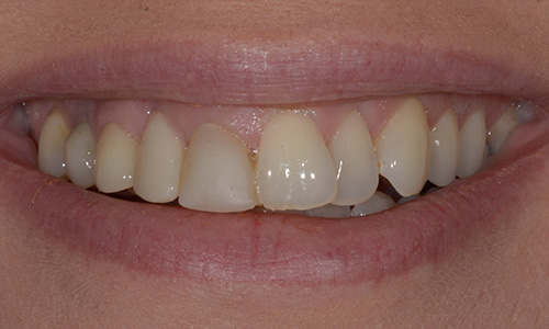 Before image