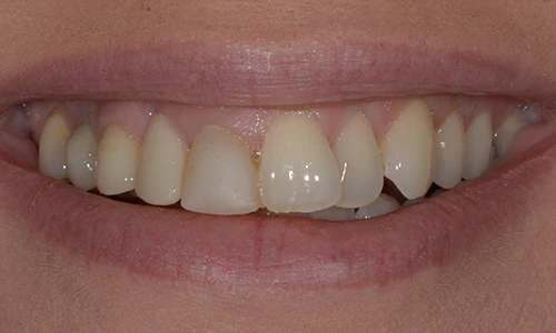 Before image