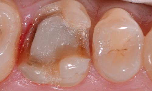 Before image