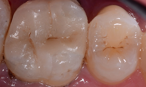 After image