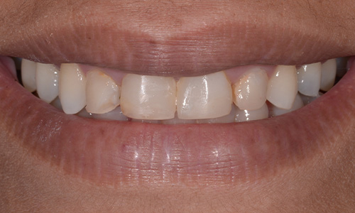 Before image